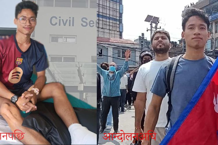 'गोली लागेर गाउँ फर्किँदा आमाले भावुक भएर भन्नुभयो– धन्न बाँचिस्! तँलाई देखेपछि सास आयो'